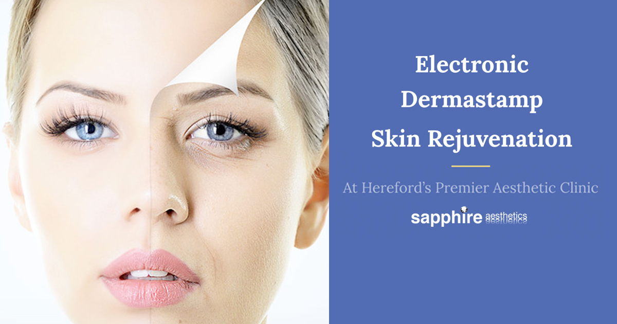 Electronic Dermastamp Skin Rejuvenation in Hereford
